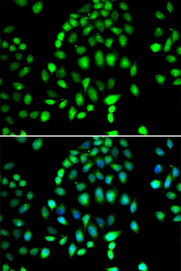 Immunofluorescence analysis of MCF-7 cells using PARP3 Polyclonal Antibody