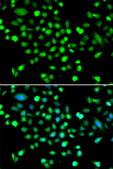 Immunofluorescence analysis of MCF-7 cells using PRKAG1 Polyclonal Antibody