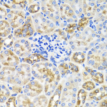 Immunohistochemistry of paraffin-embedded Mouse kidney using PRKAG1 Polyclonal Antibody at dilution of  1:100 (40x lens).