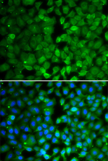 Immunofluorescence analysis of MCF-7 cells using RUNX3 Polyclonal Antibody