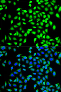 Immunofluorescence analysis of A-549 cells using SGTA Polyclonal Antibody