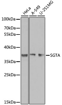 Western blot analysis of extracts of various cell lines using SGTA Polyclonal Antibody at dilution of 1:1000.