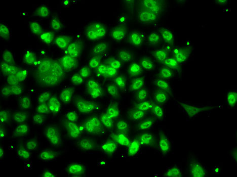 Immunofluorescence analysis of A-549 cells using SMYD3 Polyclonal Antibody