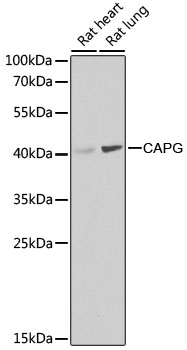 Western blot analysis of extracts of various cell lines using CAPG Polyclonal Antibody at dilution of 1:1000.