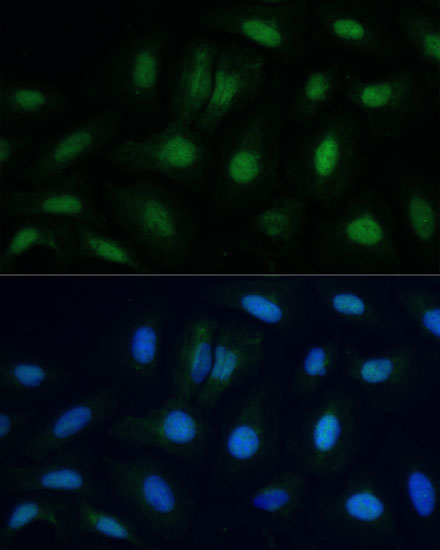 Immunofluorescence analysis of U-2 OS cells using ETS2 Polyclonal Antibody at dilution of  1:100. Blue: DAPI for nuclear staining.