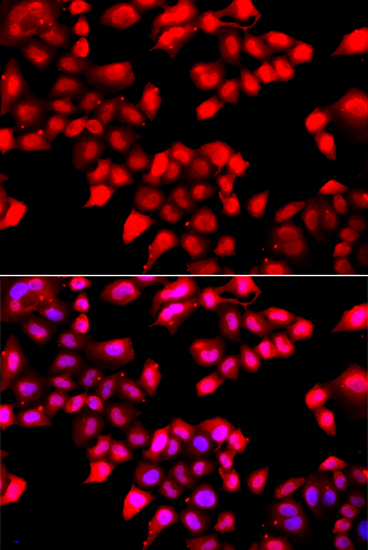 Immunofluorescence analysis of A549 cells using KU70 Polyclonal Antibody