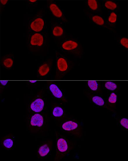Confocal immunofluorescence analysis of U2OS cells using KU70 Polyclonal Antibody at dilution of  1:100. Blue: DAPI for nuclear staining.