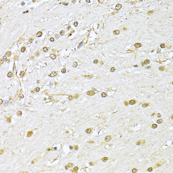 Immunohistochemistry of paraffin-embedded Rat brain using KU70 Polyclonal Antibody at dilution of  1:100 (40x lens).