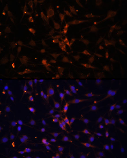 Immunofluorescence analysis of C6 cells using AMPKα2 Polyclonal Antibody at dilution of  1:100 (40x lens). Blue: DAPI for nuclear staining.