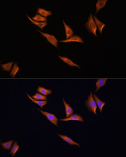 Immunofluorescence analysis of HeLa cells using AMPKα2 Polyclonal Antibody at dilution of  1:100 (40x lens). Blue: DAPI for nuclear staining.