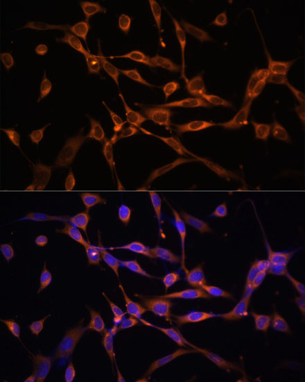 Immunofluorescence analysis of NIH-3T3 cells using AMPKα2 Polyclonal Antibody at dilution of  1:100 (40x lens). Blue: DAPI for nuclear staining.