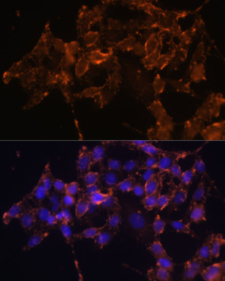 Immunofluorescence analysis of HeLa cells using PTGS1 Polyclonal Antibody at dilution of  1:100 (40x lens). Blue: DAPI for nuclear staining.