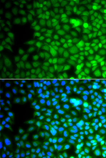 Immunofluorescence analysis of A549 cells using ZNF195 Polyclonal Antibody