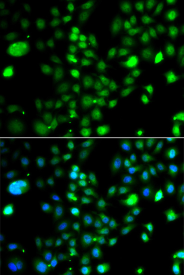 Immunofluorescence analysis of A549 cells using PRDM5 Polyclonal Antibody