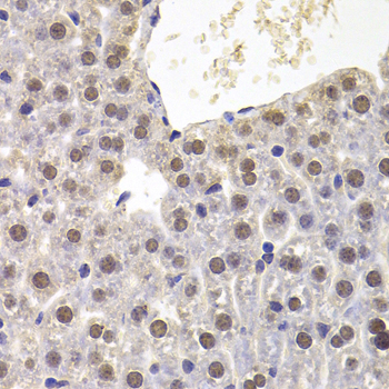 Immunohistochemistry of paraffin-embedded Mouse liver using PRDM5 Polyclonal Antibody at dilution of  1:100 (40x lens).