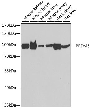 Western blot analysis of extracts of various cell lines using PRDM5 Polyclonal Antibody at dilution of 1:1000.