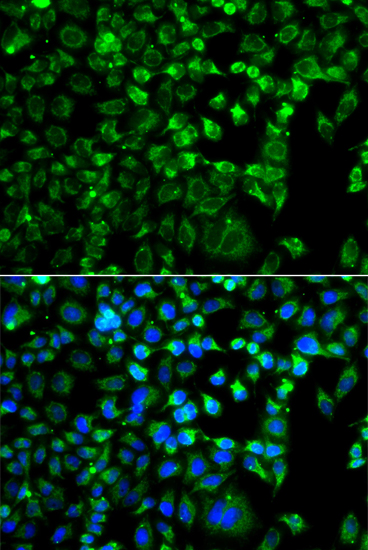 Immunofluorescence analysis of A549 cells using ZAK Polyclonal Antibody