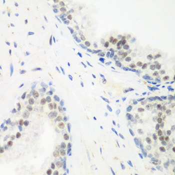 Immunohistochemistry of paraffin-embedded Human prostate using PPAN Polyclonal Antibody at dilution of  1:200 (40x lens).