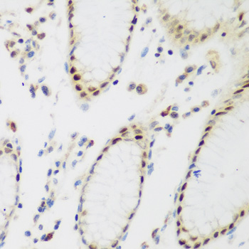 Immunohistochemistry of paraffin-embedded Human stomach using PPAN Polyclonal Antibody at dilution of  1:200 (40x lens).