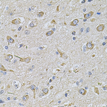 Immunohistochemistry of paraffin-embedded Rat brain using FASTKD1 Polyclonal Antibody at dilution of  1:100 (40x lens).