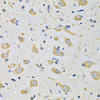 Immunohistochemistry of paraffin-embedded Mouse brain using FASTKD1 Polyclonal Antibody at dilution of  1:100 (40x lens).