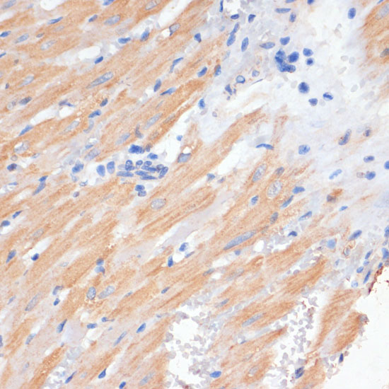 Immunohistochemistry of paraffin-embedded Rat heart using PDCD2L Polyclonal Antibody at dilution of  1:100 (40x lens).