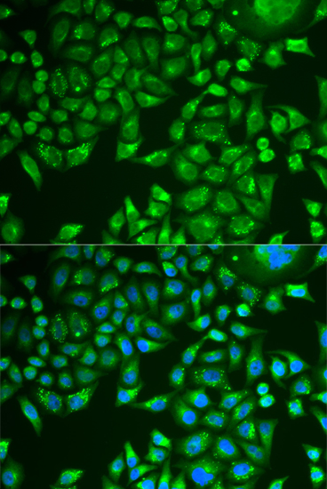 Immunofluorescence analysis of U2OS cells using PNLIP Polyclonal Antibody