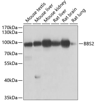 Western blot analysis of extracts of various cell lines using BBS2 Polyclonal Antibody at dilution of 1:1000.