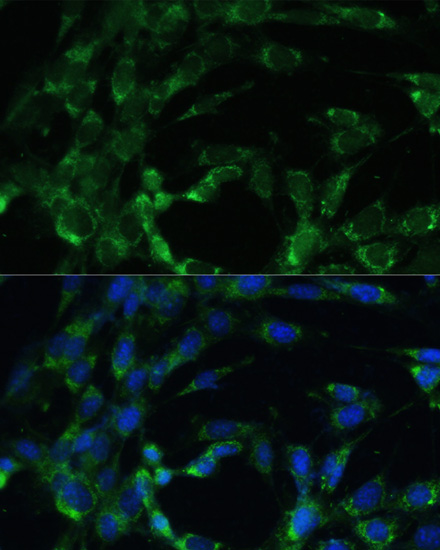 Immunofluorescence analysis of NIH-3T3 cells using BCAT2 Polyclonal Antibody at dilution of  1:100. Blue: DAPI for nuclear staining.