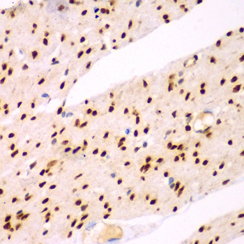 Immunohistochemistry of paraffin-embedded Human colon using TEAD3 Polyclonal Antibody at dilution of  1:100 (40x lens).