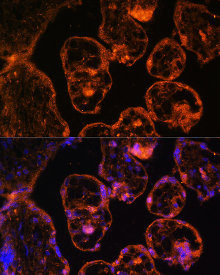 Immunofluorescence analysis of Human placenta cells using LDB3 Polyclonal Antibody at dilution of  1:100. Blue: DAPI for nuclear staining.