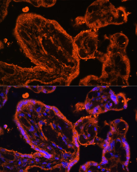 Immunofluorescence analysis of Human placenta cells using LDB3 Polyclonal Antibody at dilution of  1:100. Blue: DAPI for nuclear staining.