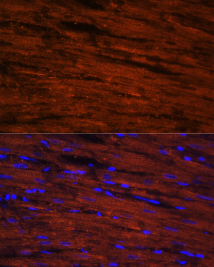 Immunofluorescence analysis of Rat heart cells using LDB3 Polyclonal Antibody at dilution of  1:100. Blue: DAPI for nuclear staining.