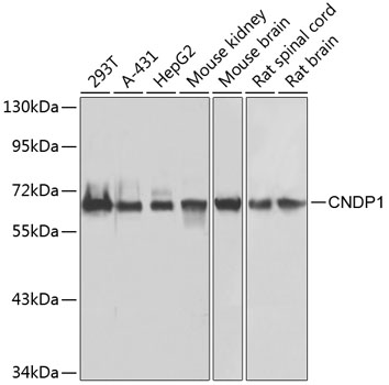 Western blot analysis of extracts of various cell lines using CNDP1 Polyclonal Antibody at dilution of 1:1000.