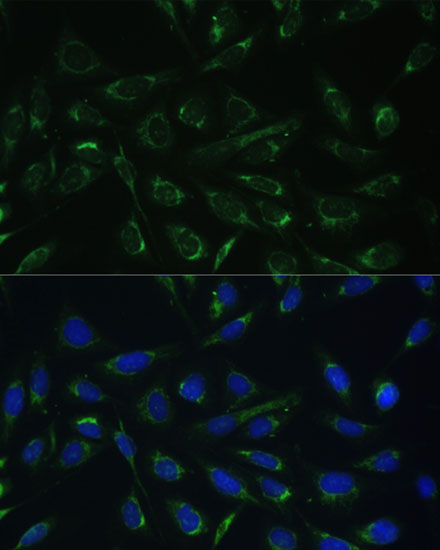 Immunofluorescence analysis of U-2 OS cells using HCCS Polyclonal Antibody at dilution of  1:100 (40x lens). Blue: DAPI for nuclear staining.
