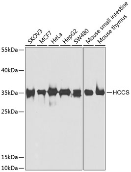 Western blot analysis of extracts of various cell lines using HCCS Polyclonal Antibody at dilution of 1:1000.