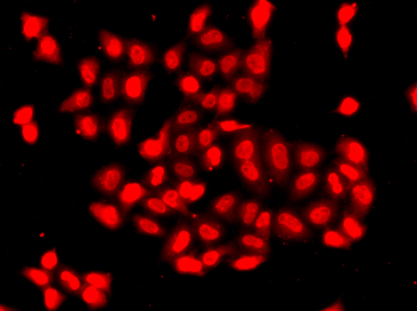 Immunofluorescence analysis of A549 cells using CAMK1D Polyclonal Antibody