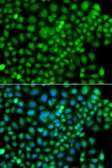 Immunofluorescence analysis of A549 cells using SUMO4 Polyclonal Antibody
