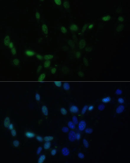 Immunofluorescence analysis of NIH/3T3 cells using SMAD9 Polyclonal Antibody at dilution of  1:100. Blue: DAPI for nuclear staining.