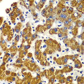 Immunohistochemistry of paraffin-embedded Human liver damage using SMAD9 Polyclonal Antibody at dilution of  1:100 (40x lens).