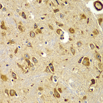 Immunohistochemistry of paraffin-embedded Mouse brain using SMAD9 Polyclonal Antibody at dilution of  1:100 (40x lens).
