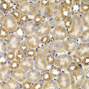 Immunohistochemistry of paraffin-embedded Mouse kidney using SMAD9 Polyclonal Antibody at dilution of  1:100 (40x lens).