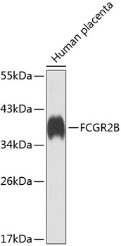 Western blot analysis of extracts of Human placenta using FCGR2B Polyclonal Antibody at dilution of 1:1000.