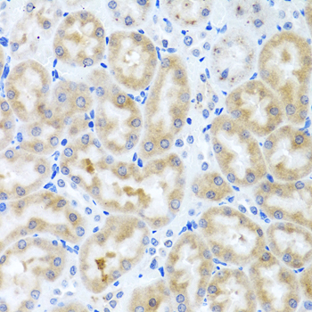 Immunohistochemistry of paraffin-embedded Rat kidney using INHBC Polyclonal Antibody at dilution of  1:100 (40x lens).