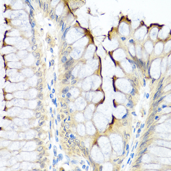 Immunohistochemistry of paraffin-embedded Human colon using INHBC Polyclonal Antibody at dilution of  1:100 (40x lens).