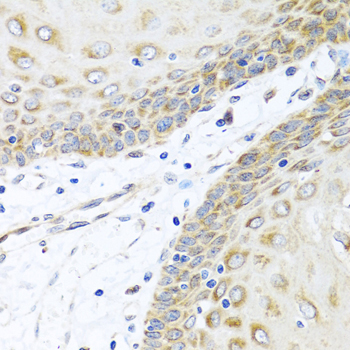 Immunohistochemistry of paraffin-embedded Human esophagus using INHBC Polyclonal Antibody at dilution of  1:100 (40x lens).