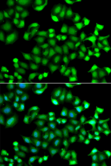 Immunofluorescence analysis of A549 cells using MAPKAPK3 Polyclonal Antibody