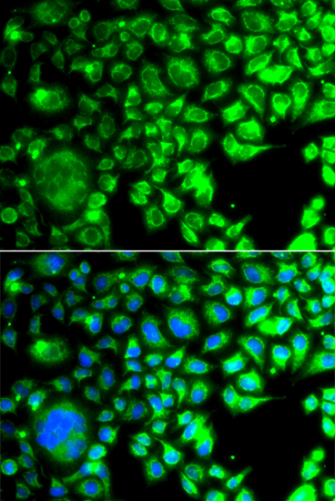 Immunofluorescence analysis of A549 cells using TBPL1 Polyclonal Antibody