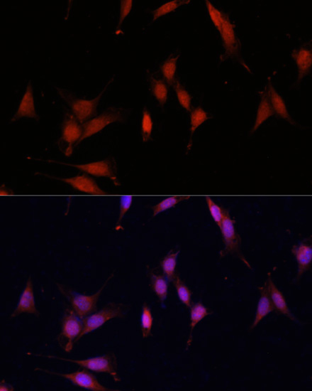 Immunofluorescence analysis of NIH/3T3 using TET3 Polyclonal Antibody at dilution of  1:100. Blue: DAPI for nuclear staining.