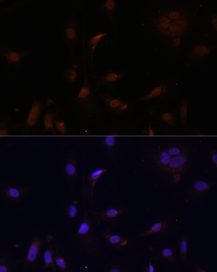 Immunofluorescence analysis of U2OS cells using TET3 Polyclonal Antibody at dilution of  1:100. Blue: DAPI for nuclear staining.